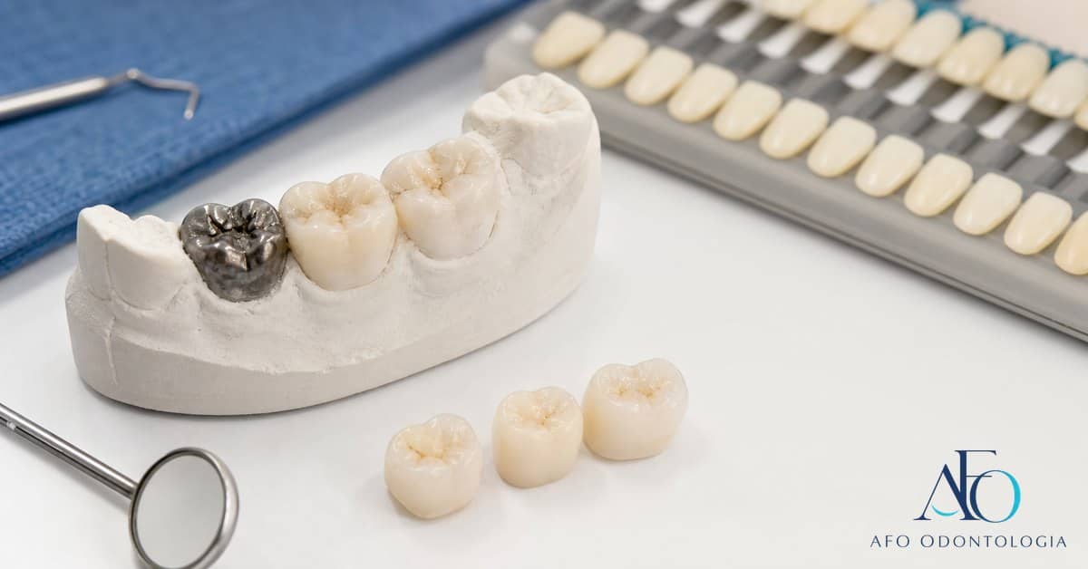 Restauração dentária avaliada em consulta na AFO Odontologia em Taboão da Serra