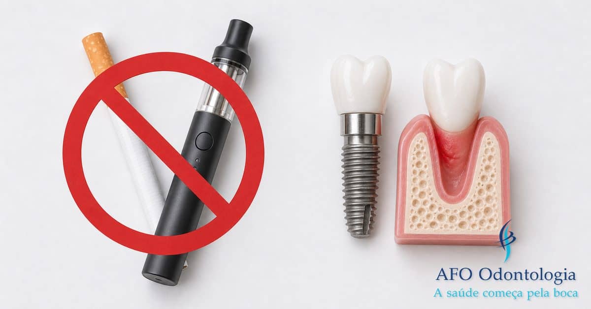 Cigarro e vape ao lado de implante dentário — tabagismo aumenta significativamente o risco de falha no implante, Taboão da Serra