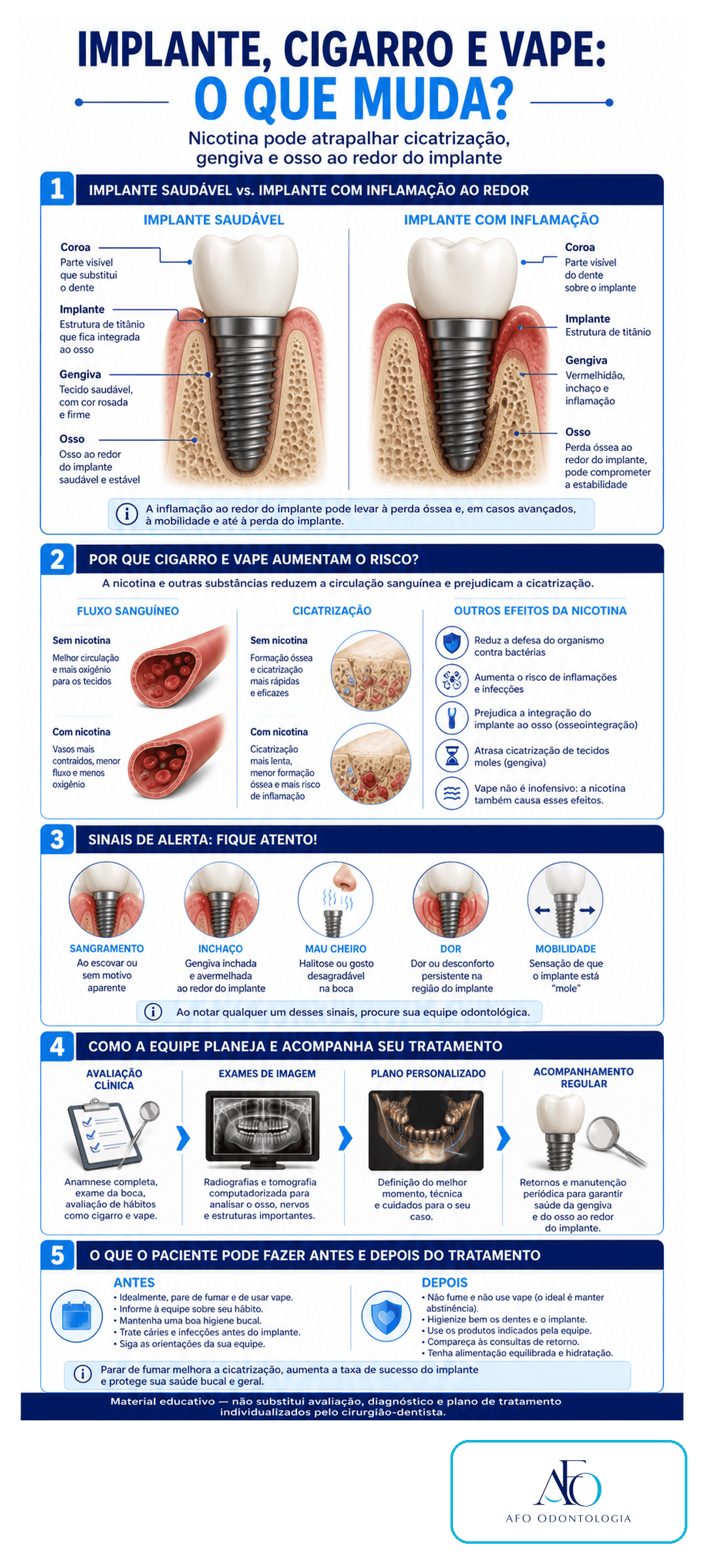 Infográfico sobre cigarro, vape, implante dentário, cicatrização, gengiva e osso