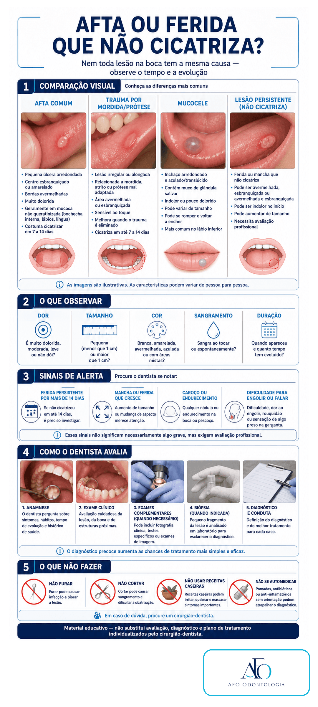 Infográfico sobre afta, trauma, mucocele e feridas persistentes na boca