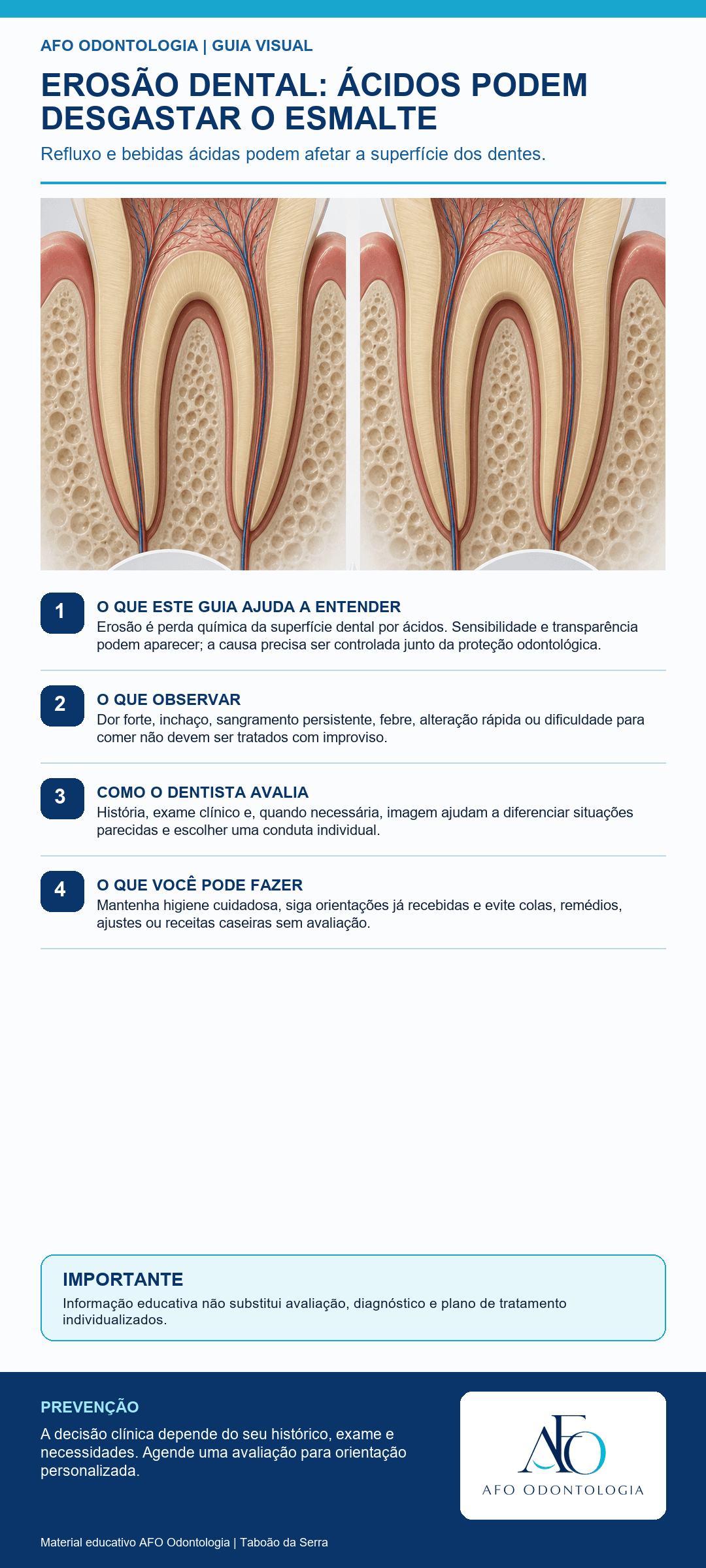 Infográfico AFO: Erosão dental: ácidos podem desgastar o esmalte em Taboão da Serra
