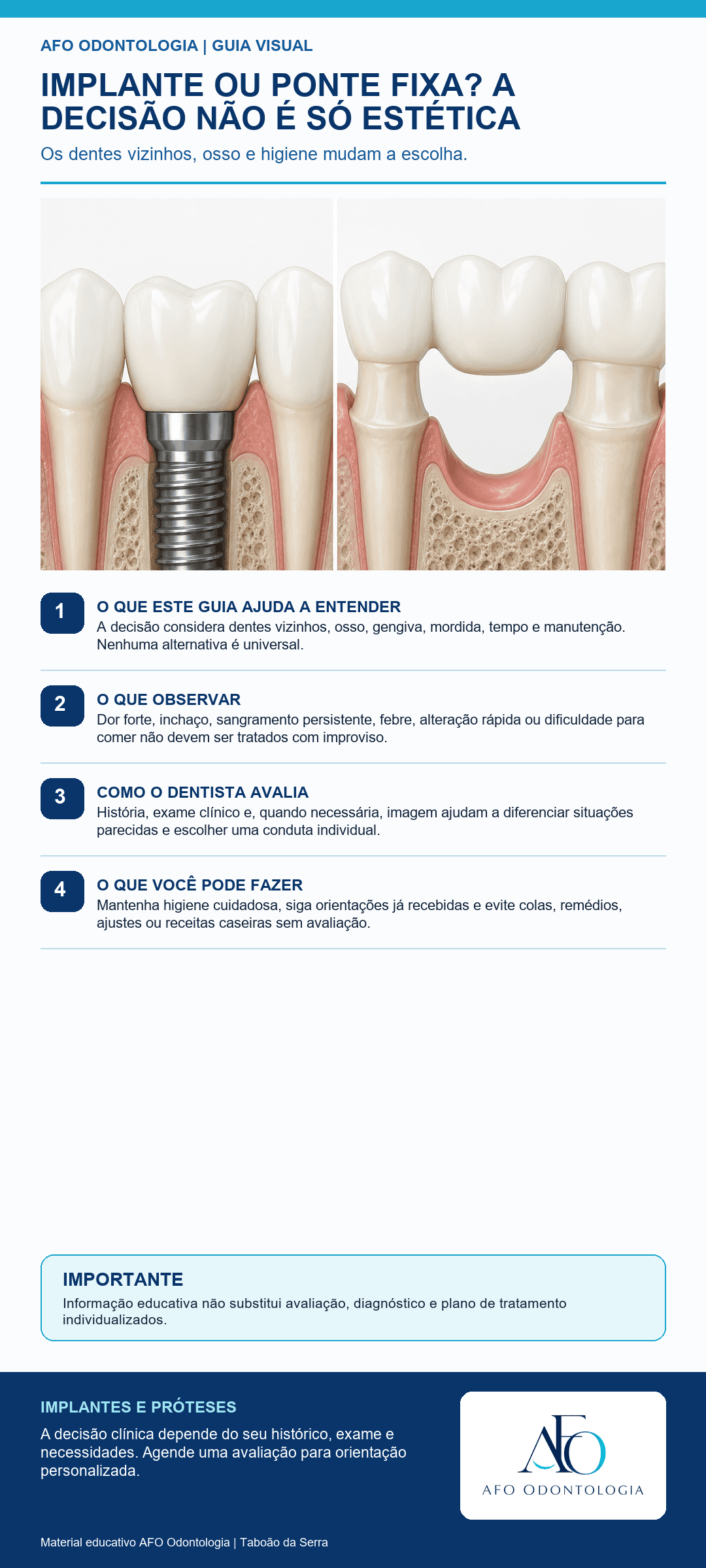 Infográfico AFO: Implante ou ponte fixa? A decisão não é só estética em Taboão da Serra