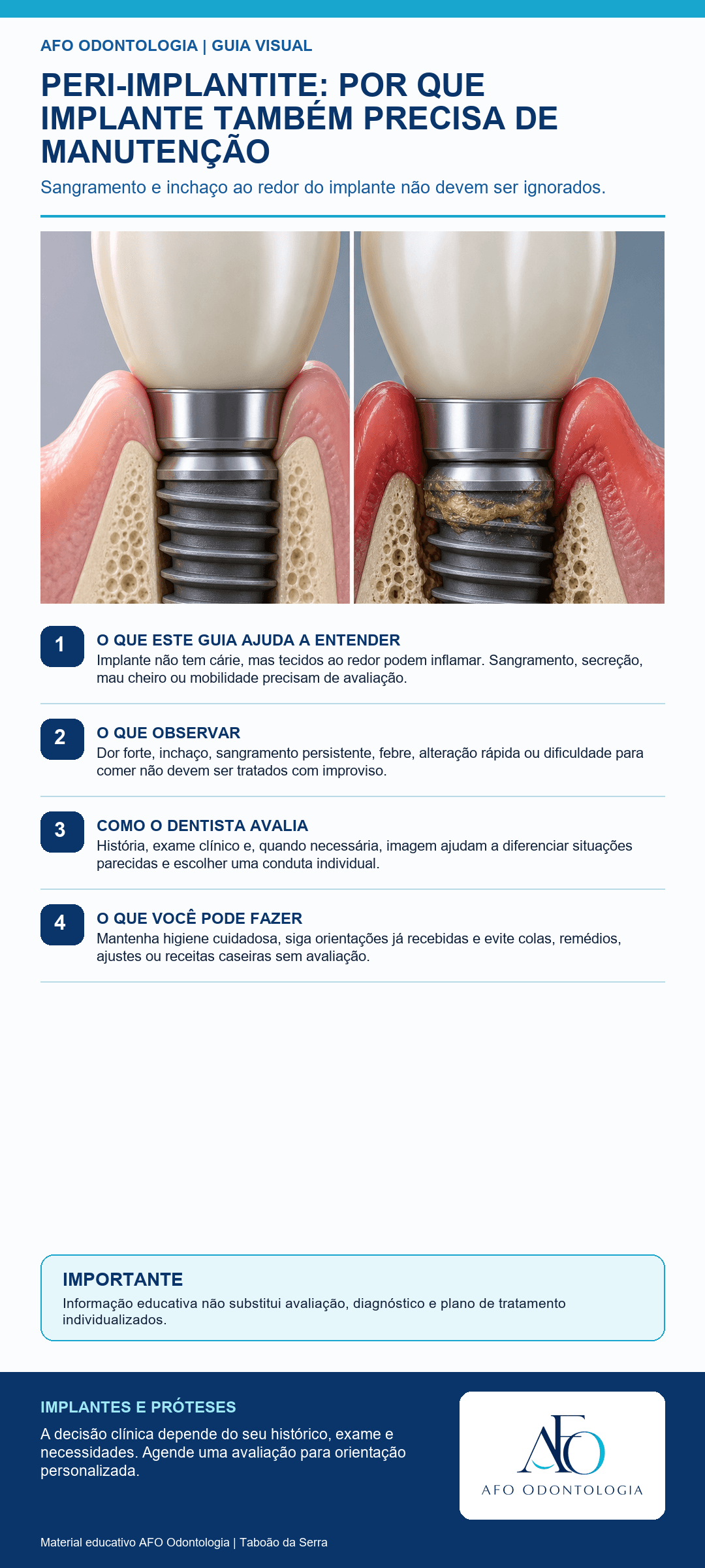 Infográfico AFO: Peri-implantite: por que implante também precisa de manutenção em Taboão da Serra