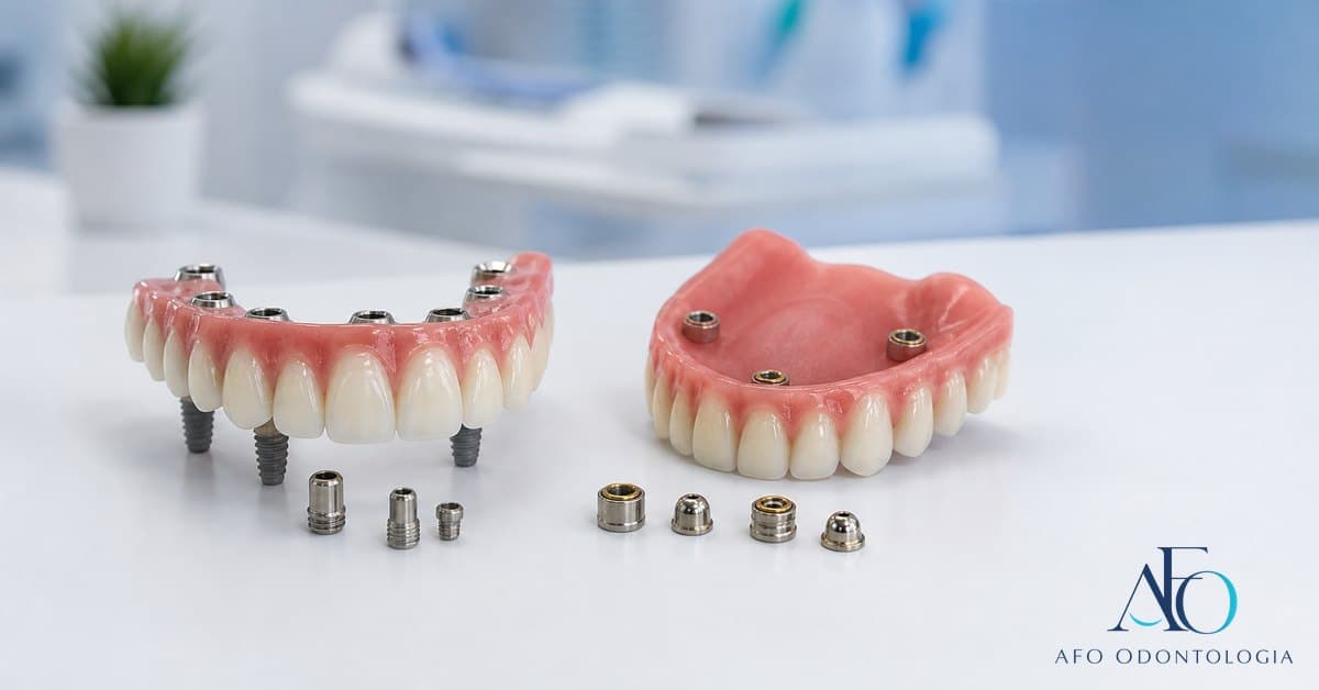 Comparação entre prótese protocolo e overdenture sobre implantes em bancada odontológica em Taboão da Serra