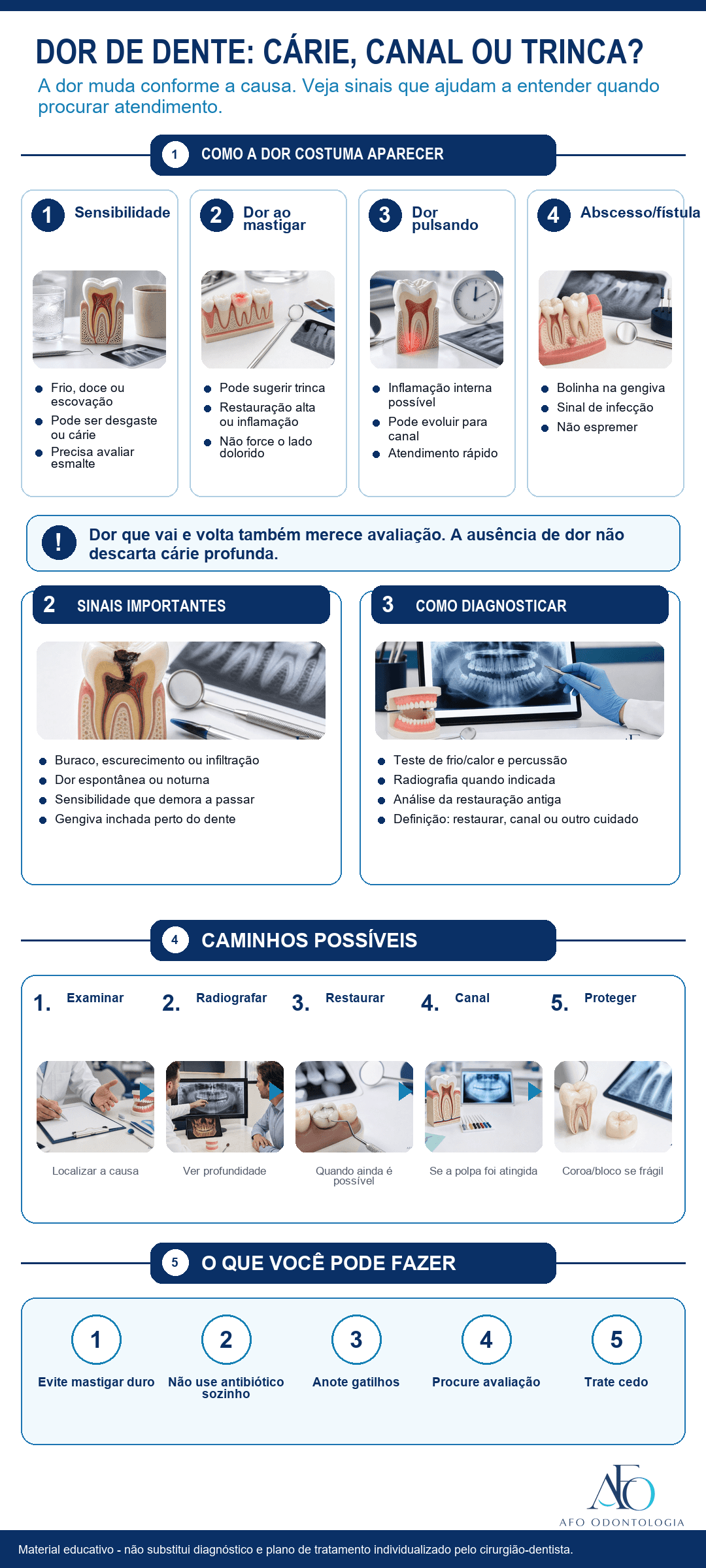Infográfico sobre dor de dente, cárie profunda, tratamento de canal e trinca dental